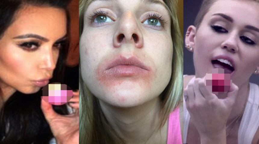 &Uuml;nl&uuml;lerin kullandığı dudak kremi bu hale getirdi