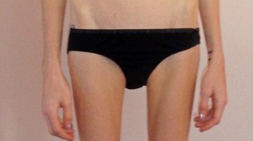  Doktorlar yaşama şansı vermedi ama mucizeyi başardı