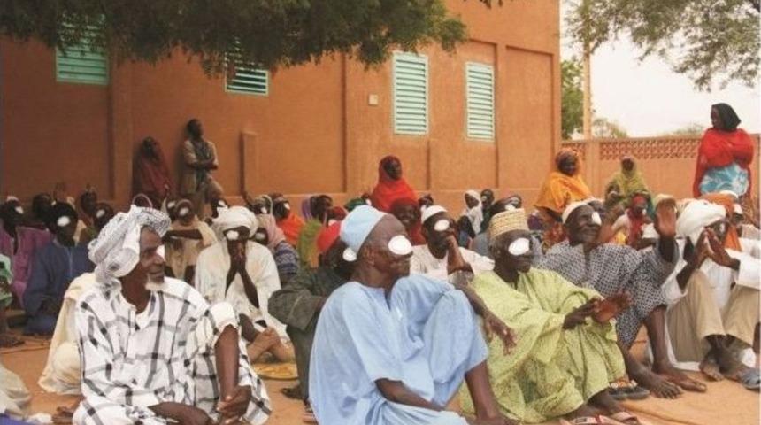 Sorgun Dost G&ouml;n&uuml;ller Gıda Bankası Nijer Halkı İ&ccedil;in Katarakt Ameliyat Kampanyası Başlattı