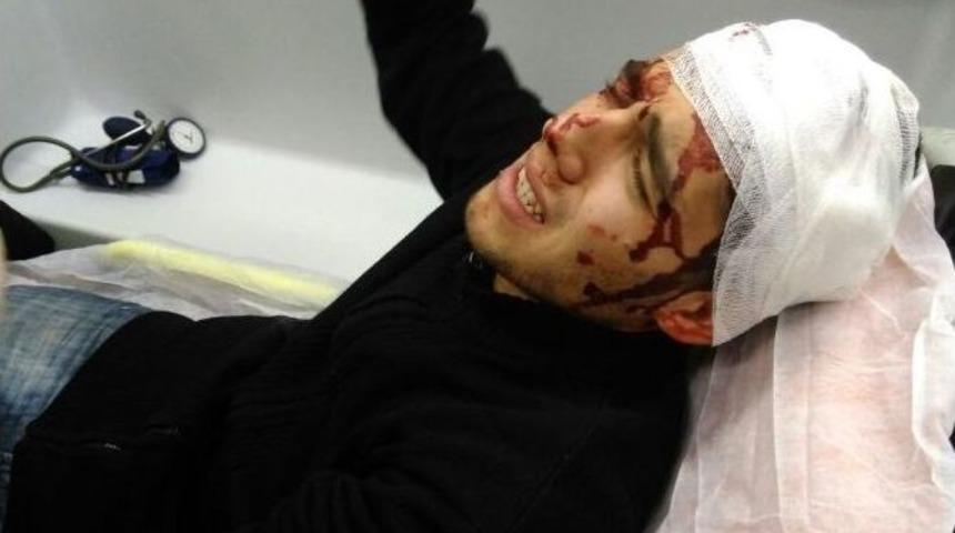 Hırsızlık Yaptı Dayak Yedi, Son İşinde Tutuklandı