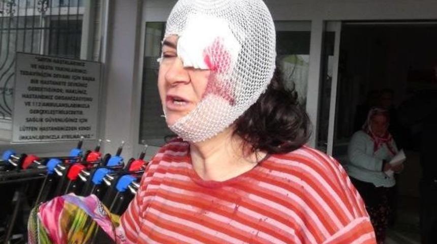 Eşi Ve Kayınbiraderi Tarafından D&ouml;v&uuml;len Kadın Hastanelik Oldu
