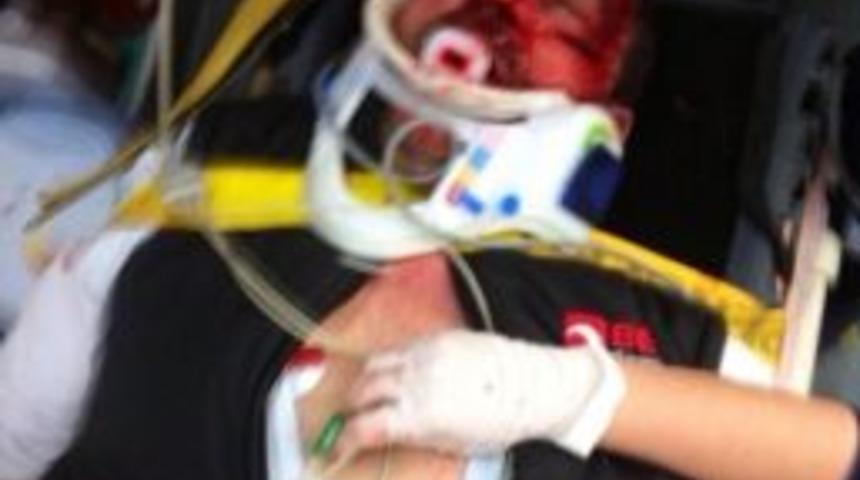 Sakarya&rsquo;da Trafik Kazası: 1 Yaralı