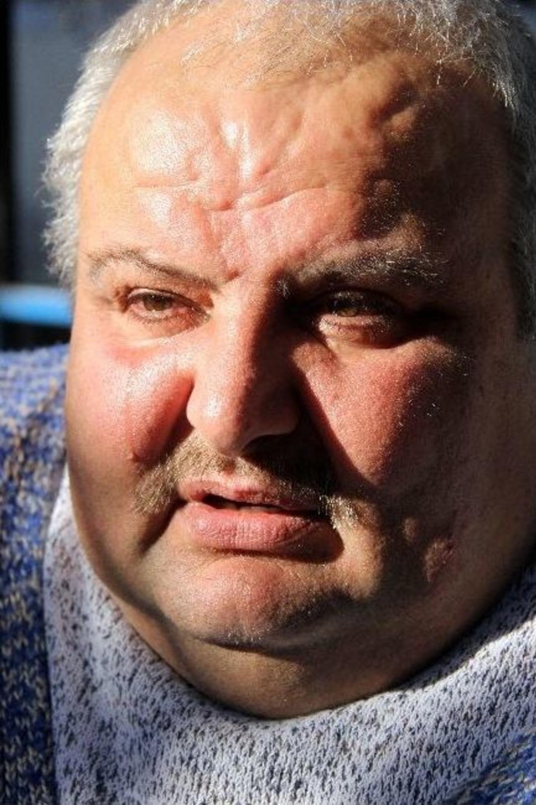 292 Kiloluk Adamın Umut G&ouml;zyaşları