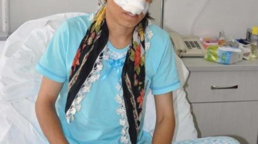 Eşinin Burnunu Kesen Koca Hakkında Işkence Su&ccedil;undan Da Ceza Istendi