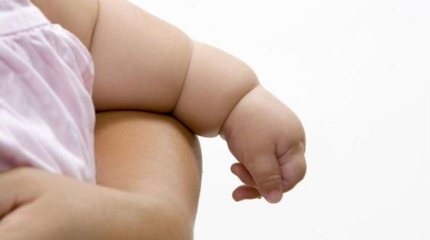 &Ccedil;ocuğun Şişmanlığından Aile Sorumlu