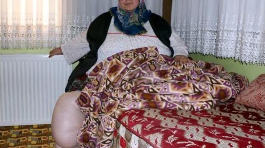 230 Kiloyla Hapis Hayatı Yaşıyor