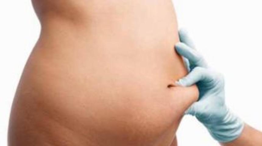 Hamilelik Sonrası V&uuml;cut Bozukluğu