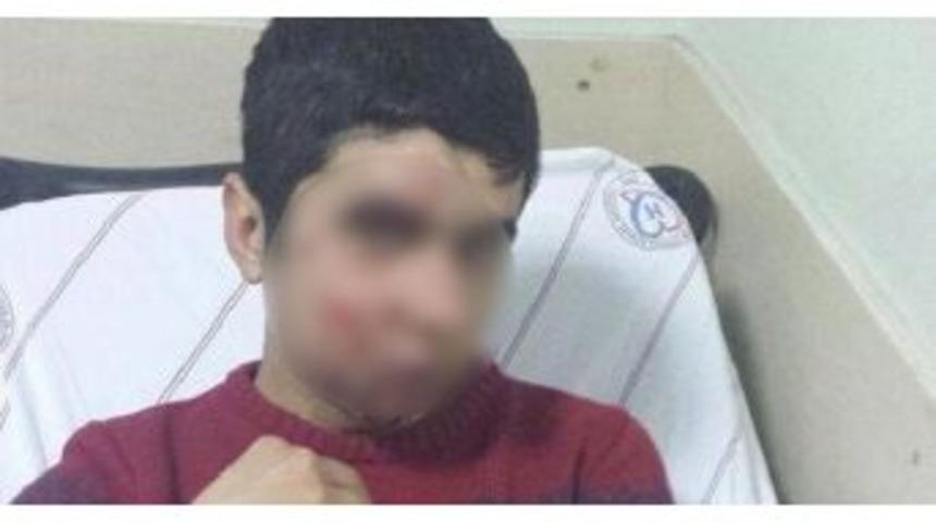 Gaz Kaps&uuml;l&uuml; Değil Taş Yaraladı