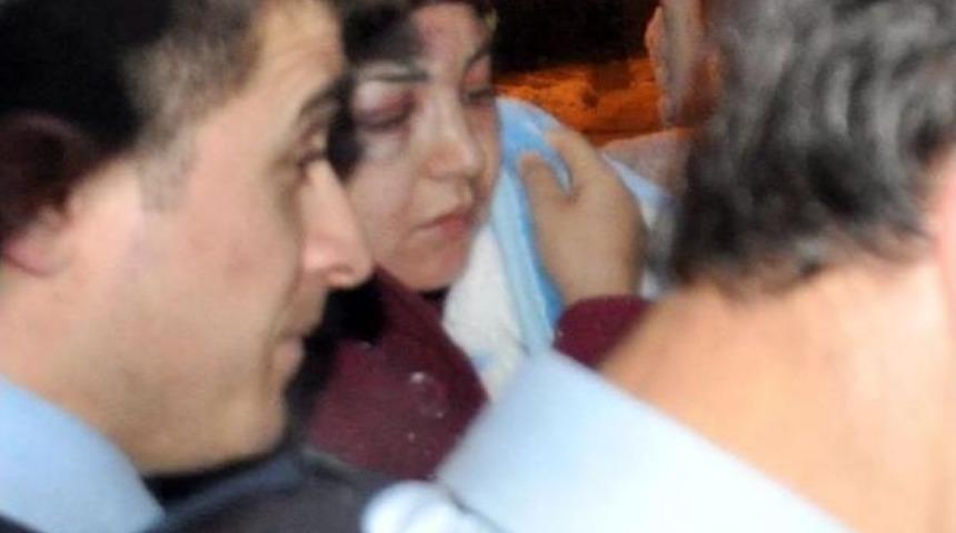 Şiddetten Ka&ccedil;an Kadına Polis Koruması