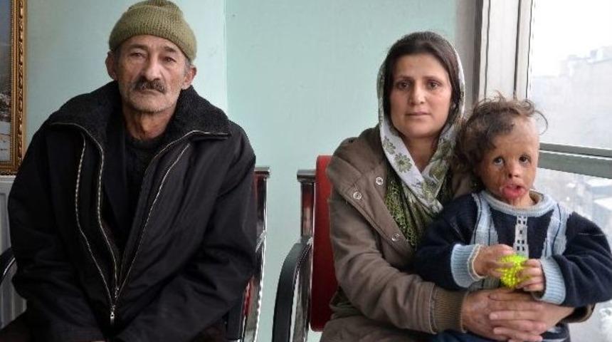 K&uuml;&ccedil;&uuml;k Demhat Tedavi Olmayı Bekliyor