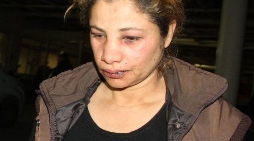 Dayak&ccedil;ı Koca: "eşimi Ayıltmak İ&ccedil;in Tokatladım"