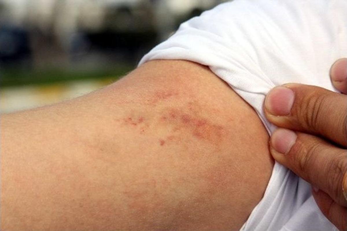 (&ouml;zel Haber) Manken Tuğba &Ouml;zay&rsquo;dan Servis S&uuml;r&uuml;c&uuml;s&uuml;ne "bagaj" Dayağı