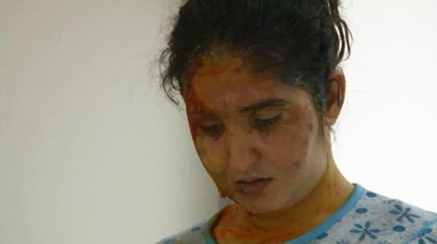 Koca Şiddeti Gen&ccedil; Kadının Hayatını Kararttı