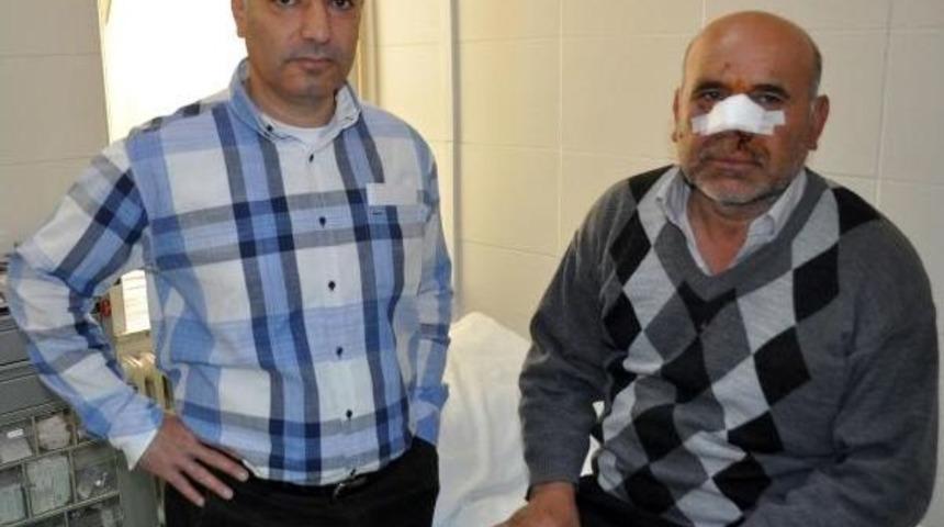 Burnu Kesilince 5 Hastane Gezen Hastaya 2 G&uuml;n Gecikmeli Dikiş Atıldı