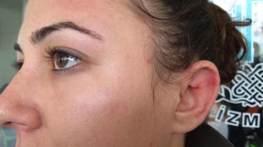 Ebru'yu, 'kadınlar G&uuml;n&uuml;'nde Boşanma Davası A&ccedil;tığı Eşi D&ouml;vd&uuml;