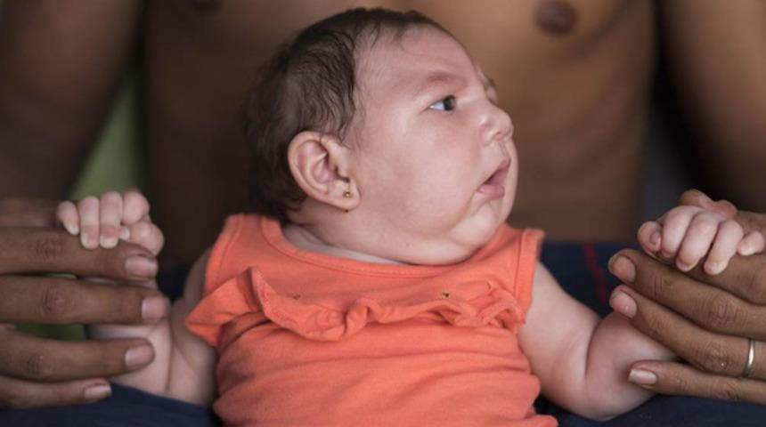 Hamilelerin korkulu r&uuml;yası zika vir&uuml;s&uuml;