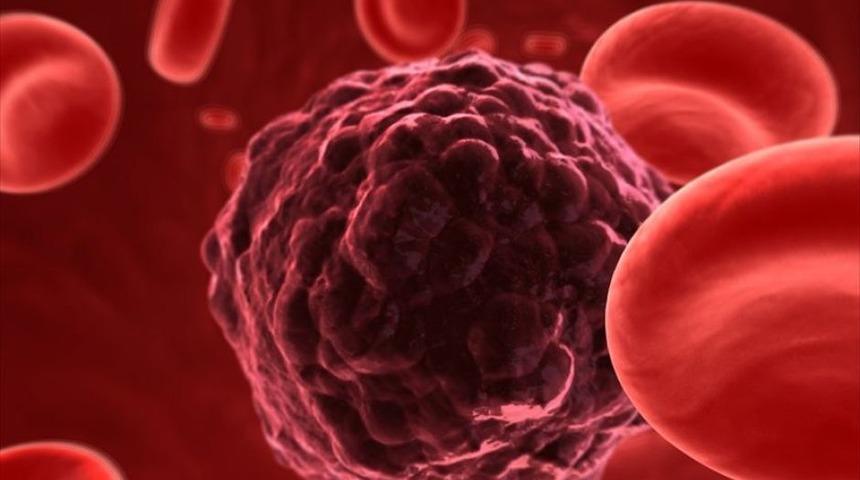 5 soruda &ccedil;ağımızın hastalığı kanser ve kanseri &ouml;nlemenin yolları