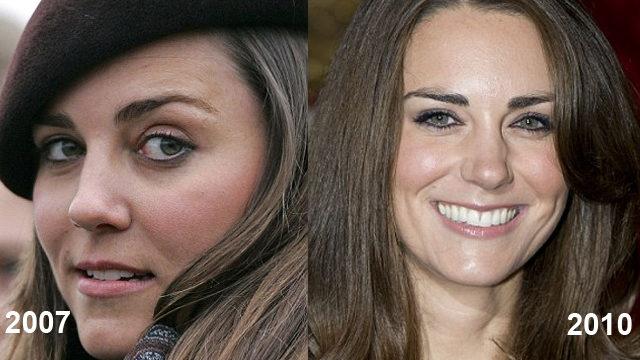 kate-middleton 7