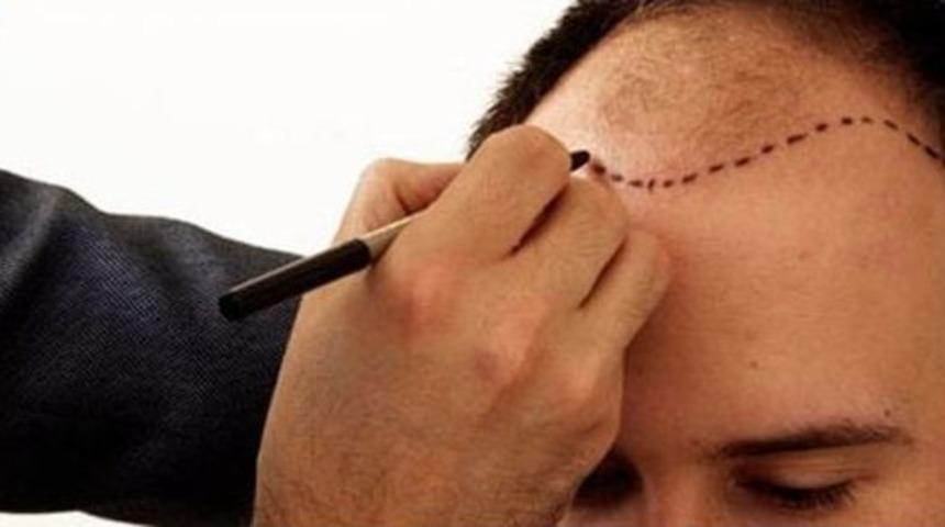 Sa&ccedil; Ekimi Cildi De Koruyor