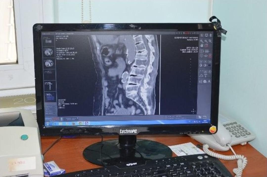 Beli Kıralan 90 Yaşındaki Hastaya Kemik &Ccedil;imentosu