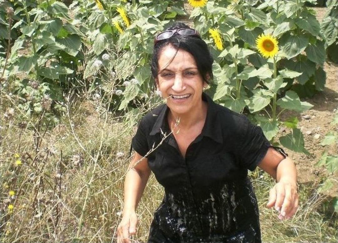 (&ouml;zel Haber) Kaburgasından Ve Kulağından Burun Yapıldı Hayatı Kabusa D&ouml;nd&uuml;