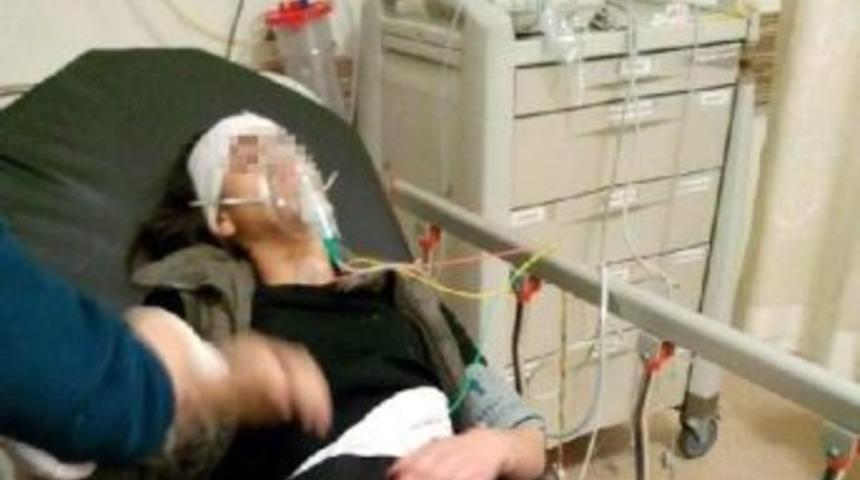 14-Year-Old Girl Wounded In Head With Tear Gas Cartridge