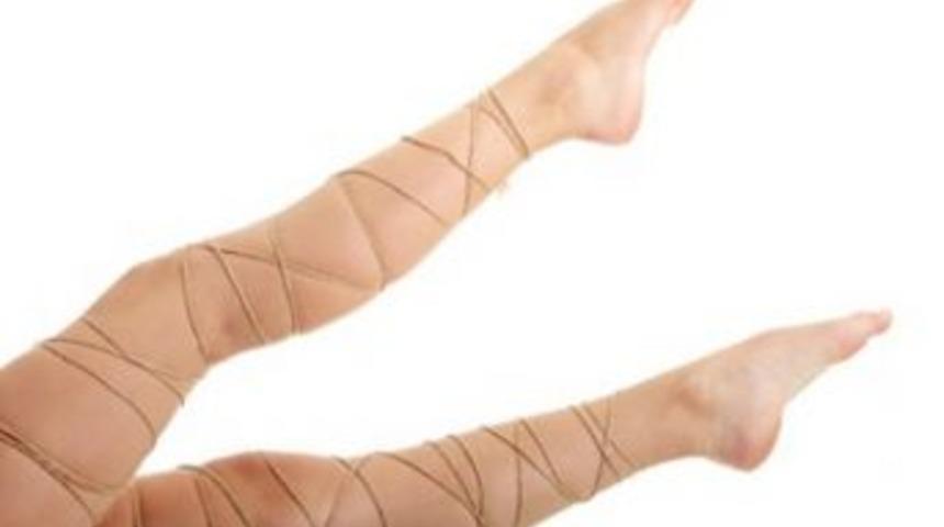 Yaz Gelmeden Varis Tedavisi Olun