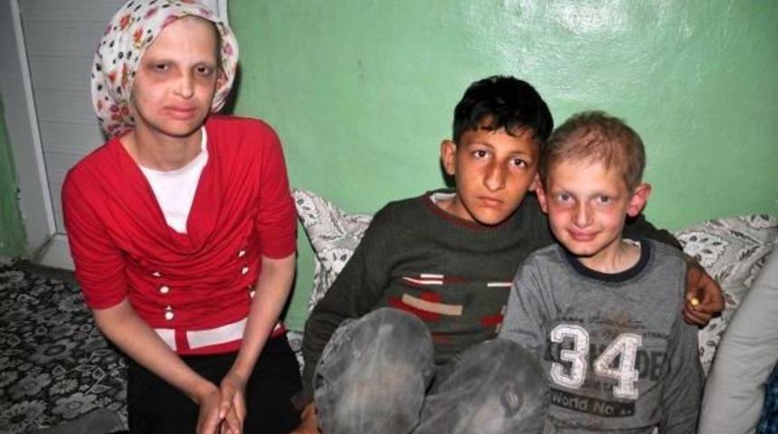 &Ccedil;ocukları Konuşamıyor, Dişi Yok Ve Sa&ccedil;ları &Ccedil;ıkmıyor