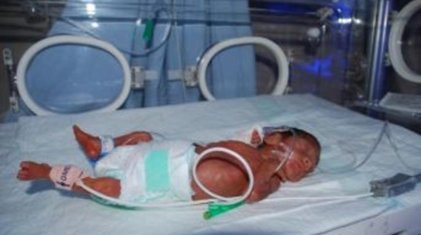 700 Gram Ağırlığındaki Bebek Hayata Tutunamadı