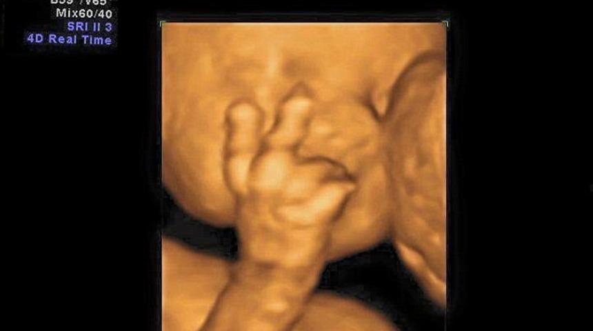 Anne karnındaki mucize anlar