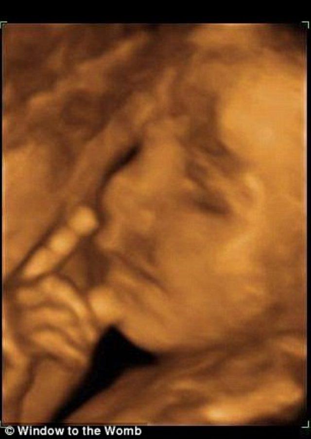 bebek-ultrason 3