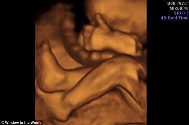 bebek-ultrason 4