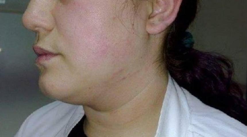 Hastanede Dayak Iddiasına Soruşturma