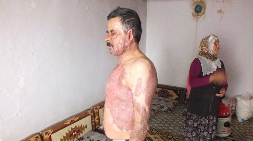 (&ouml;zel Haber) Yangında K&uuml;le D&ouml;nen Hayat