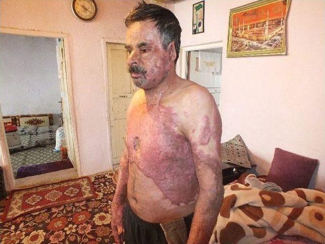 (özel Haber) Yangında Küle Dönen Hayat 2