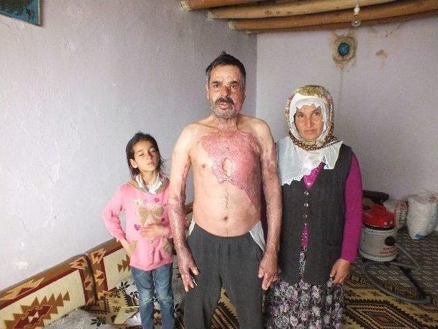 (özel Haber) Yangında Küle Dönen Hayat 3