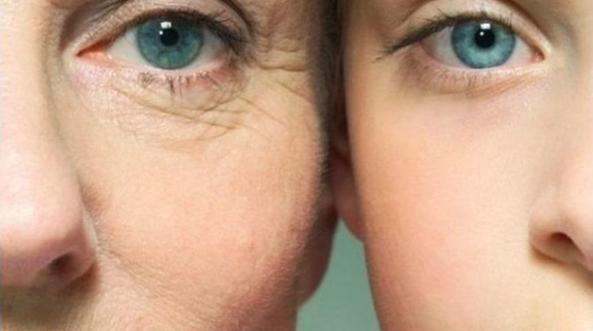 G&ouml;zleri Kısarak Bakmak Yaşlandırıyor