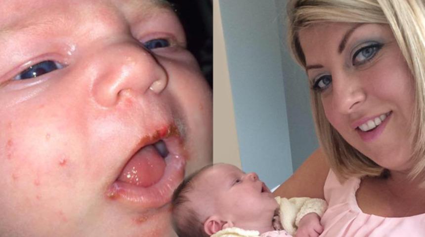 Ebeveynler dikkat! &Ccedil;ocuğu neredeyse &ouml;p&uuml;c&uuml;k y&uuml;z&uuml;nden &ouml;l&uuml;yordu