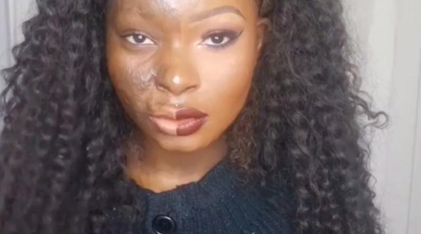 Y&uuml;z&uuml; yanan kadın makyajın g&uuml;c&uuml;n&uuml; b&ouml;yle kanıtladı