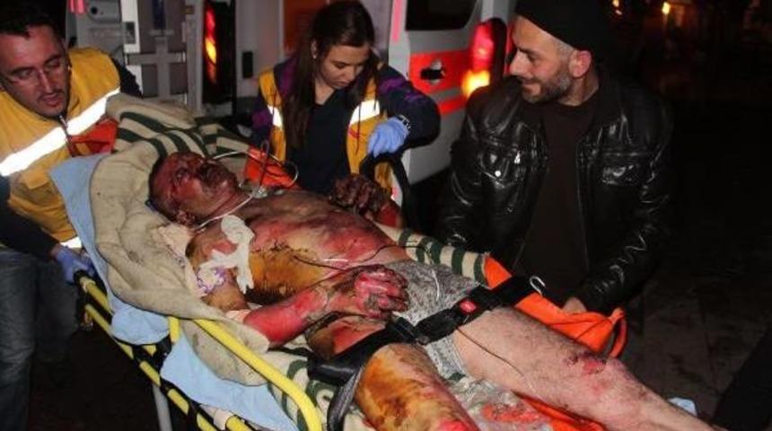 Evinde &Ccedil;ıkan Yangında Yaralandı