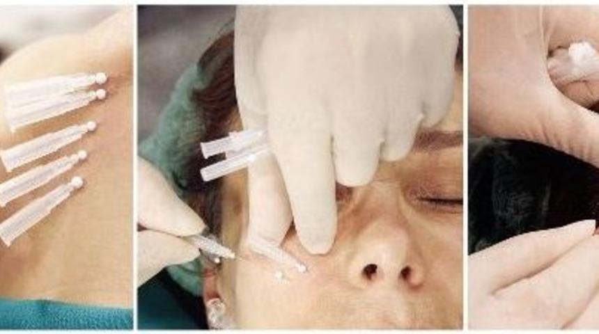 &Ouml;r&uuml;mcek Ağı Estetiği Yine G&uuml;ndeme Oturdu