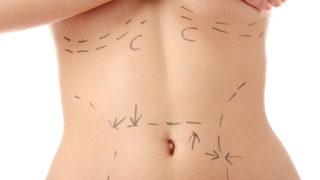 Hangi liposuction tekniği size daha uygun? Lazer mi Vazer mi? 