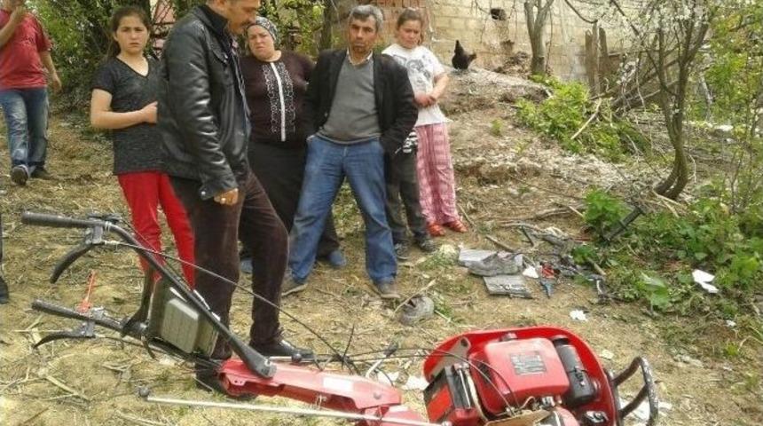 Ayağını &Ccedil;apa Makinesine Kaptırdı