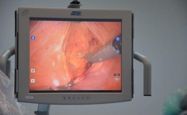 Da Vinci Robotik Cerrahi Sistemi Şanlıurfa’da G1