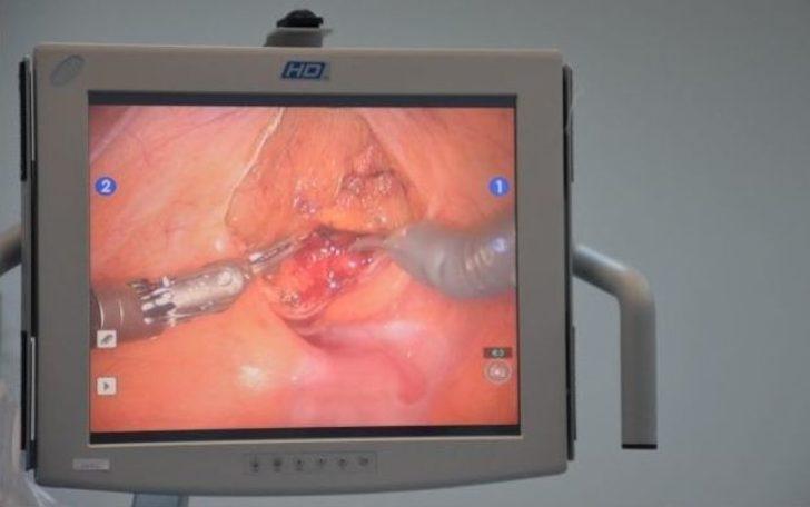 Da Vinci Robotik Cerrahi Sistemi Şanlıurfa’da G2