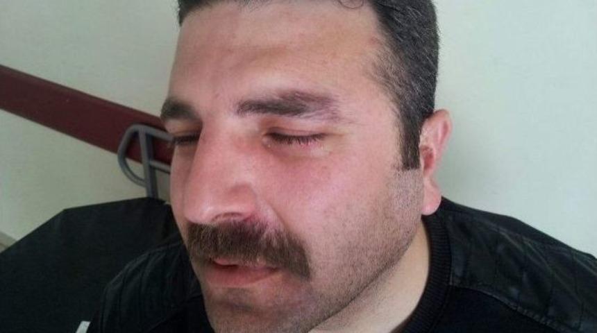 Sağlık Memurunu Darp Ettiler