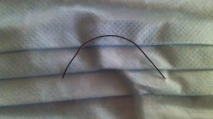 Helvanın İ&ccedil;inden &Ccedil;ıkan Tel Boğazına Saplandı