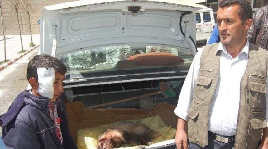 Eve Giren Porsuk &Ccedil;ocuğun Yanağını Ve Parmağını Kopardı