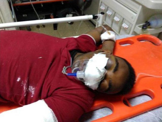 Karakolun 3 &uuml;nc&uuml; Katından Atlayan Sudanlı Ka&ccedil;ak Yaralandı 1