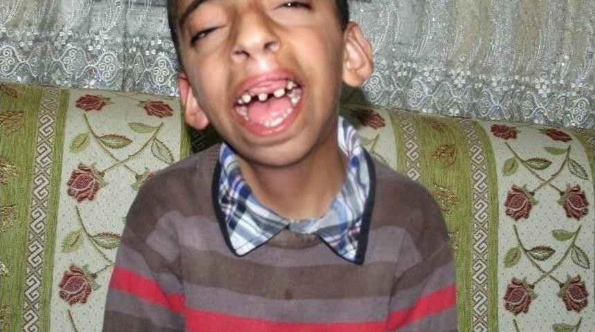 Yozgat&rsquo;ta 12 Yaşındaki Muhammet Ameliyat İ&ccedil;in Yardım Bekliyor